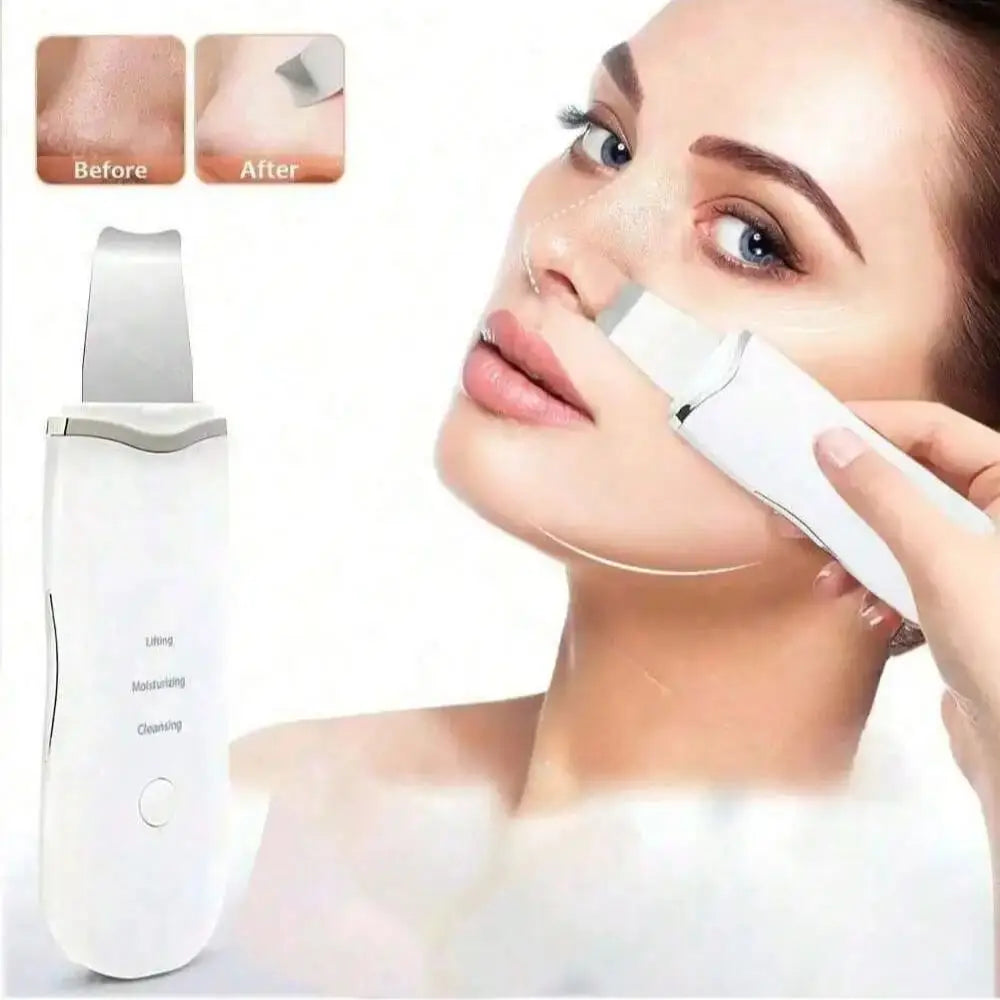 Ultrasonic Skin Scrubber Scrubber Deep Vibrate Facial Cleaner Shovel Face Scrubber Peeling Black Head Remover Facial Massager