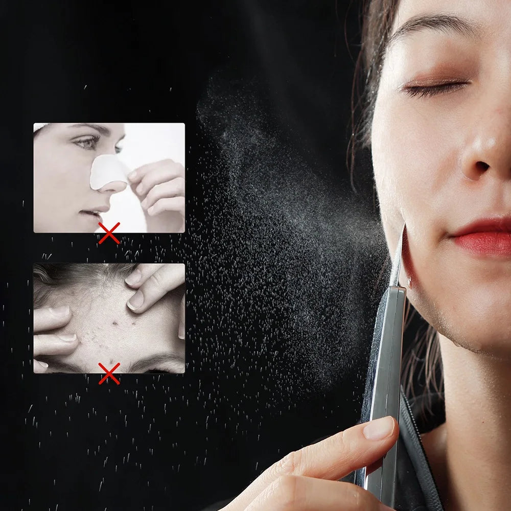 6 in 1 EMS Ultrasonic Skin Scrubber ION LED Photon Skin Lifting Massager Face Spatula Blackhead Remover Facial Deep Cleansing