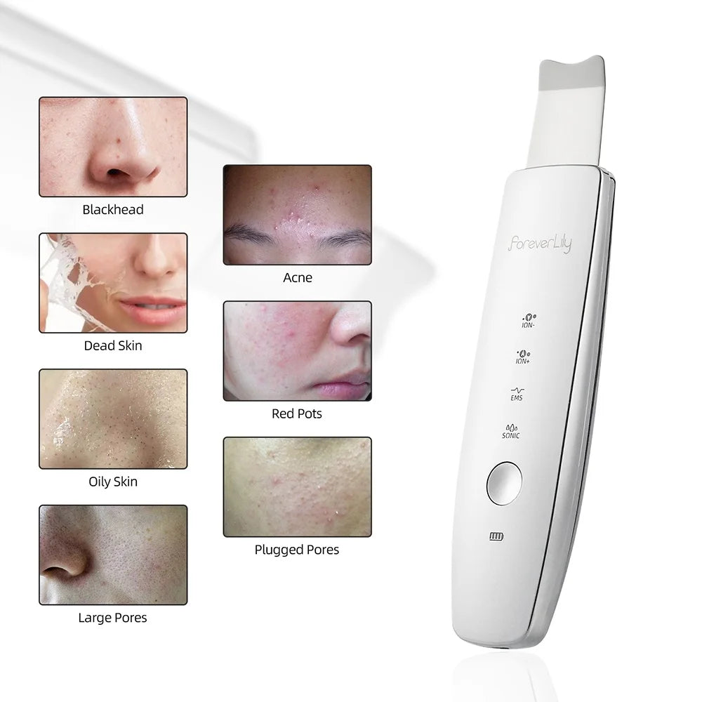 6 in 1 EMS Ultrasonic Skin Scrubber ION LED Photon Skin Lifting Massager Face Spatula Blackhead Remover Facial Deep Cleansing