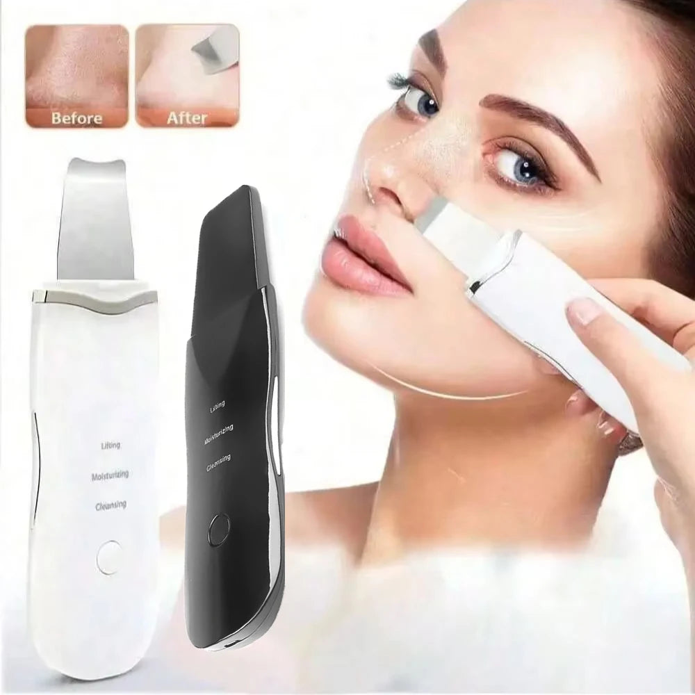 Ultrasonic Skin Scrubber Scrubber Deep Vibrate Facial Cleaner Shovel Face Scrubber Peeling Black Head Remover Facial Massager