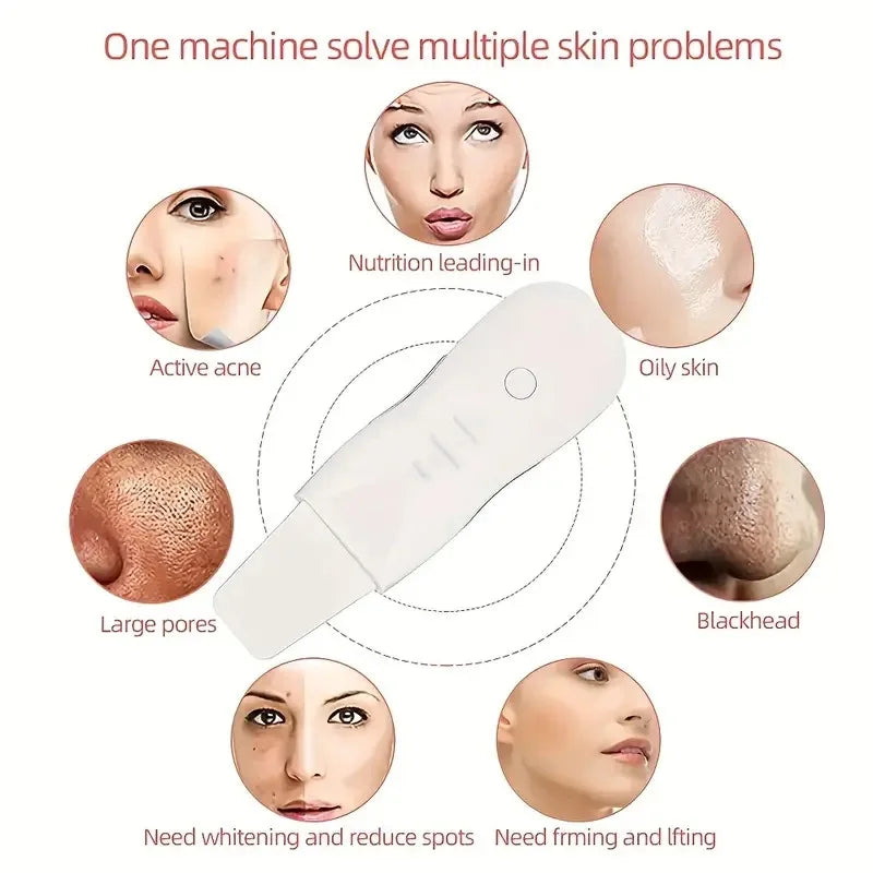 Ultrasonic Skin Scrubber Electric Ultrasonic Peeling Machine Deep Vibrate Facial Cleaner Acne Removal Blackhead Pore Cleaner