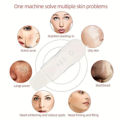 Ultrasonic Skin Scrubber Electric Ultrasonic Peeling Machine Deep Vibrate Facial Cleaner Acne Removal Blackhead Pore Cleaner