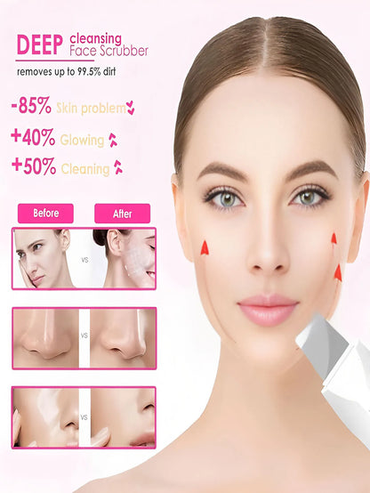 Ultrasonic Skin Scrubber Scrubber Deep Vibrate Facial Cleaner Shovel Face Scrubber Peeling Black Head Remover Facial Massager