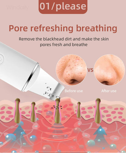 Ultrasonic Skin Scrubber Vibration Face Spatula Blackhead Remover Shovel Clean Cavitation Peeling Facial Lifting Skin Care Tools