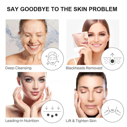 Ultrasonic Skin Scrubber Vibration Face Spatula Blackhead Remover Shovel Clean Cavitation Peeling Facial Lifting Skin Care Tools