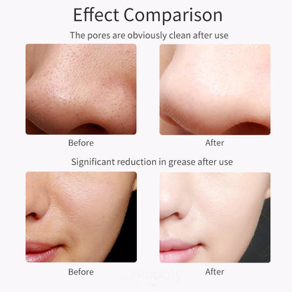 Ultrasonic Skin Scrubber Vibration Face Spatula Blackhead Remover Shovel Clean Cavitation Peeling Facial Lifting Skin Care Tools