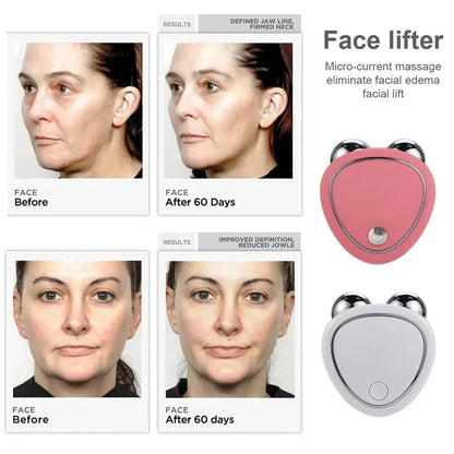 Levantamiento Facial Con Microcorriente Antiarrugas, Microcurrent Facial Device, Microcurrent Face Lift Machine, Dispositivo De
